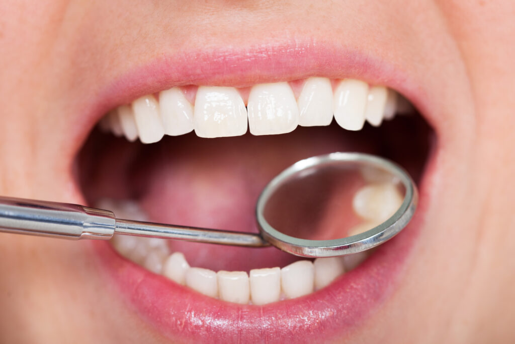 口を開けて歯科用器具で歯を確認する