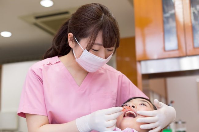 子どもの口に床矯正を装着しようとしている歯科衛生士