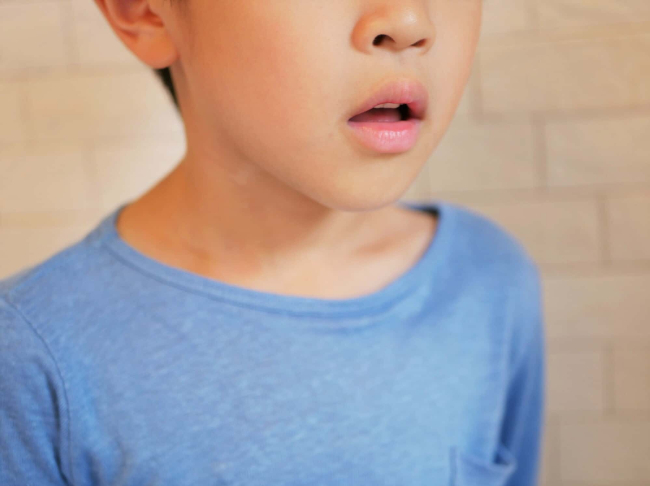 歯並びが悪くなる原因の一つである口呼吸をする子ども