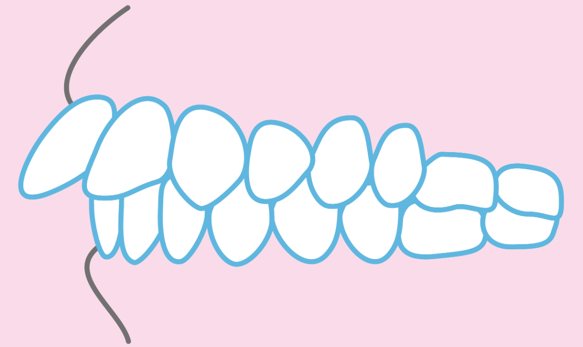 出っ歯の歯のイラスト