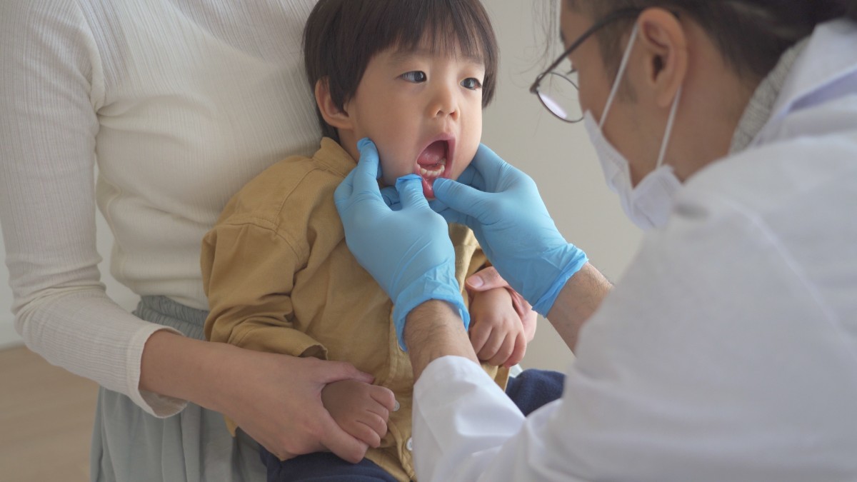 小児矯正 1 期治療中の子ども