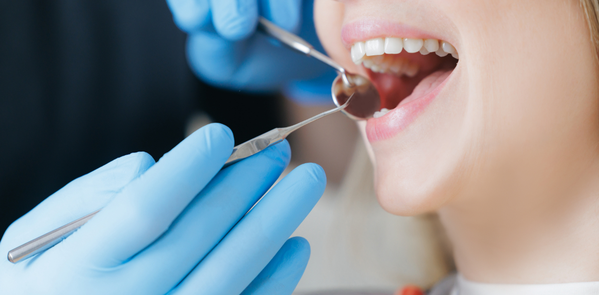 親知らずを抜くために診察している歯科医師