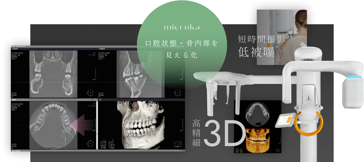 口腔状態・骨内部を見える化／短時間撮影 低被曝／高精細3D