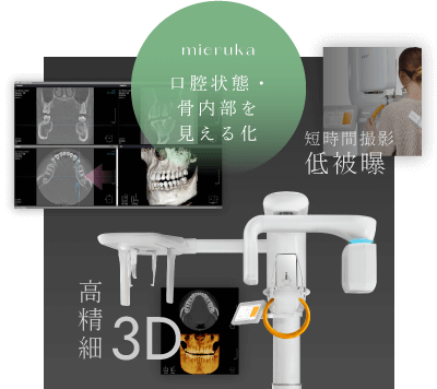 口腔状態・骨内部を見える化／短時間撮影 低被曝／高精細3D